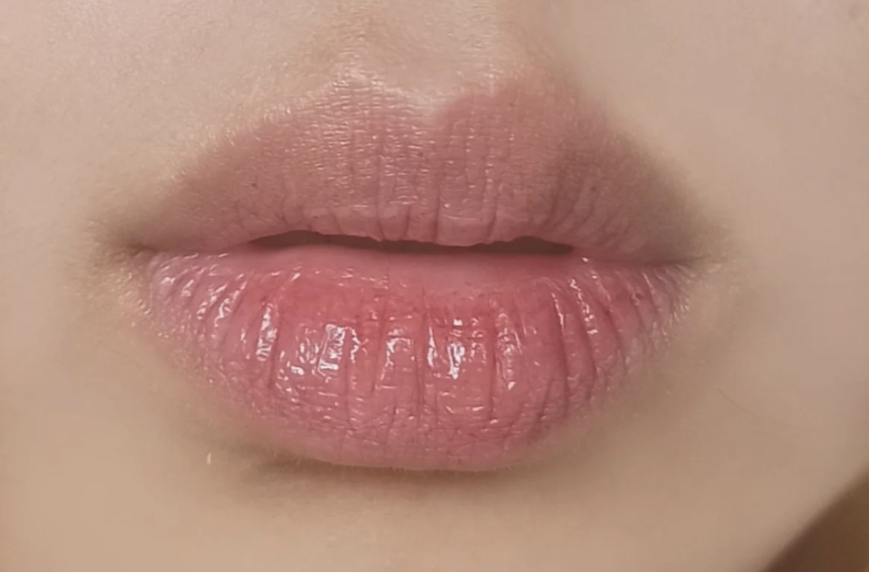 蒂尔施|嘴唇经常起干皮，还越来越“紫”？可能是这几个原因，很影响颜值
