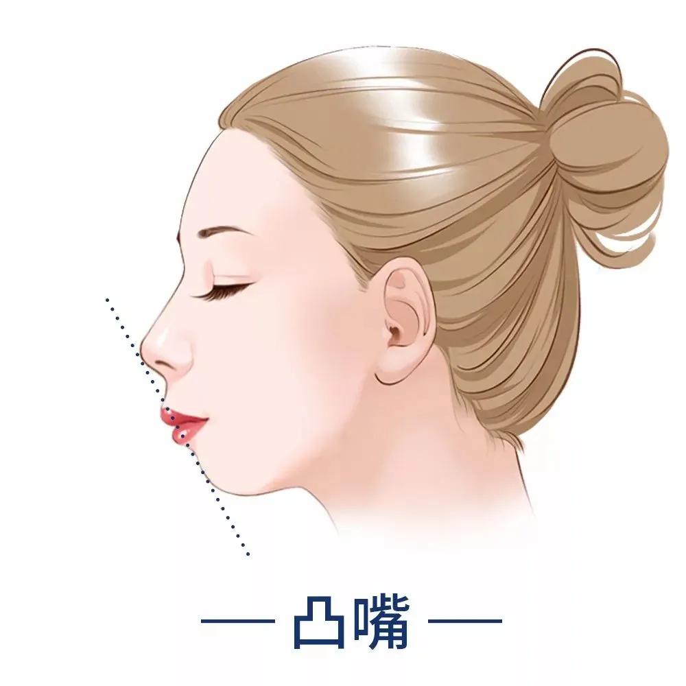 瘦脸|什么脸型瘦了不好看