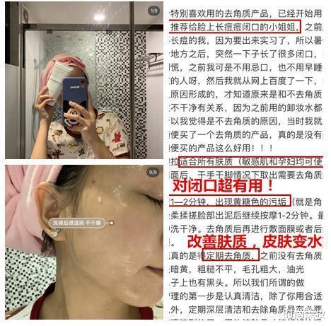时尚美妆|孙艺珍的素颜照惊艳到我了！皮肤嫩得掐出水，旁边的素人好吃亏