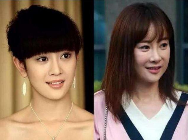 整容|初见惊为天人，再见脸僵如石！这10位女星的脸，到底怎么了