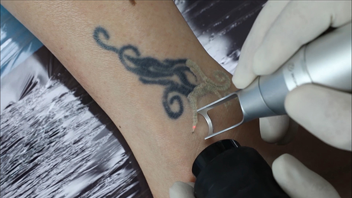 齐姐育儿|13岁女孩背着妈妈偷偷纹身，被告知需要两年时间清洗，且还会留疤