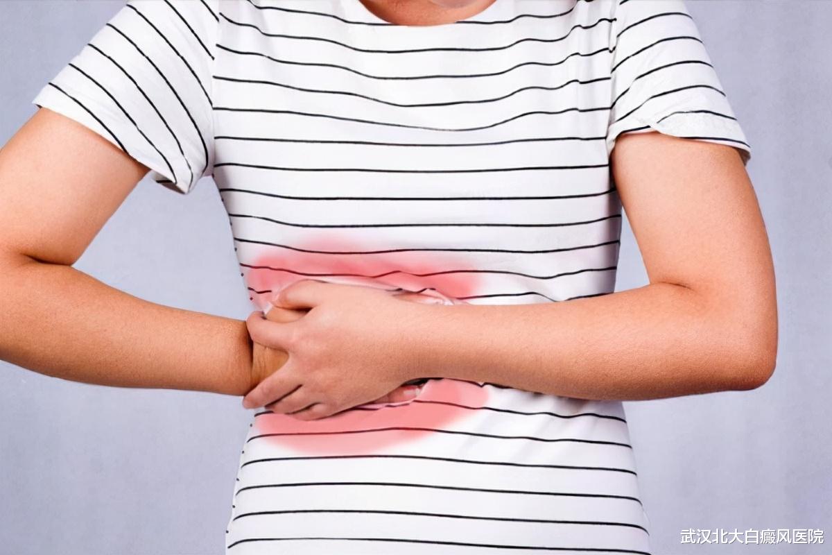 肝脏|长期吃药损伤肝脏,白癜风患者该如何缓解?