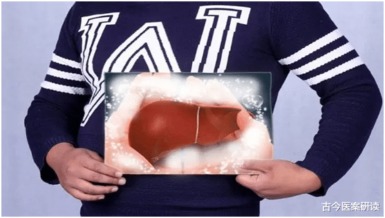 古今医案研读|为何肝癌患者越来越多?医生提醒:身体一旦出现“2红、2黄”,尽早检查