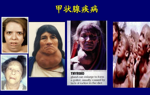 橘子|甲状腺癌“祸首”找到了，并非橘子，坚持每天吃，甲功一天天变强