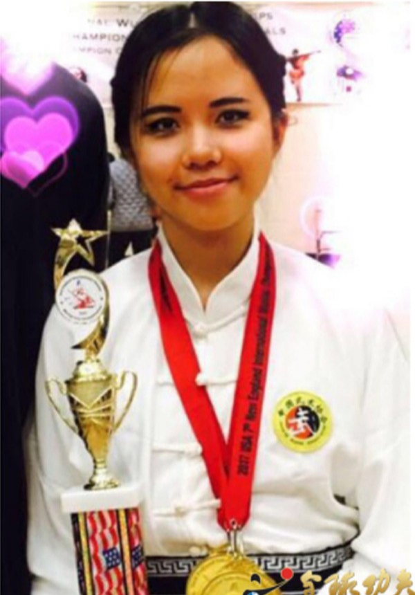 计春华|因中毒惨遭毁容，无发无眉演尽坏蛋，计春华去世后妻女近况如何？