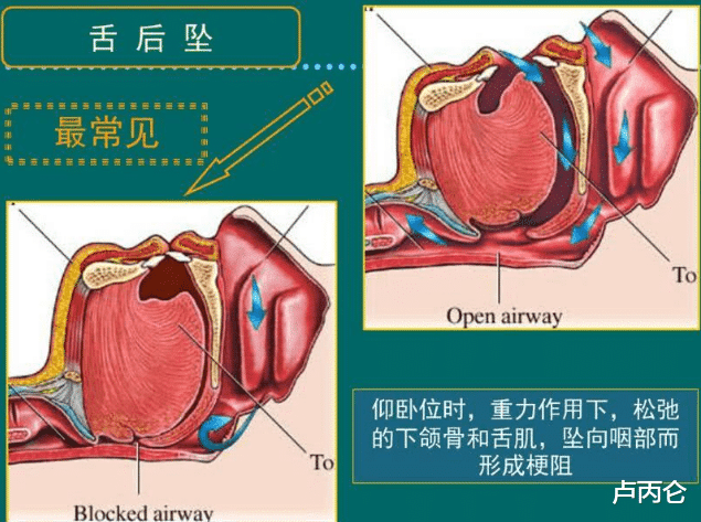 痔疮|一条伤疤要看三、四个科室,是医生在骗钱吗?