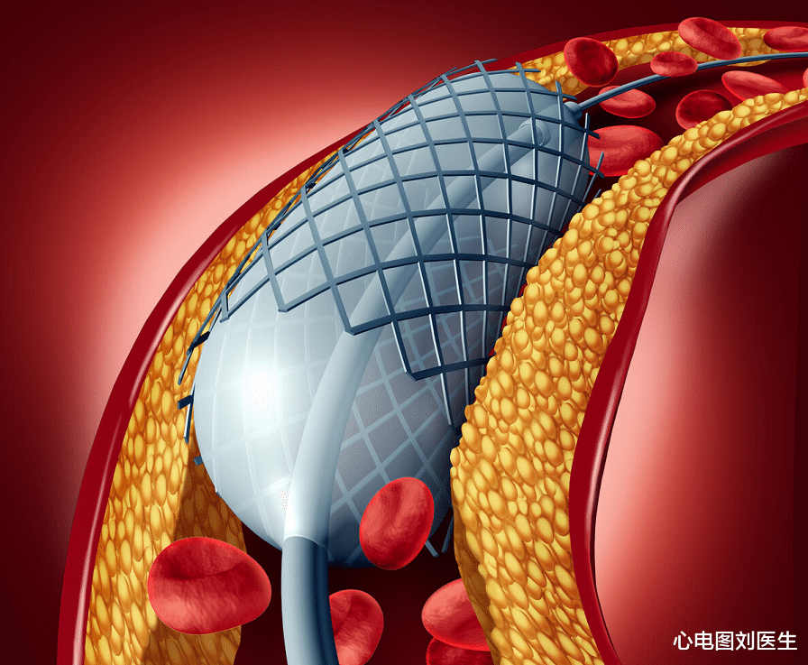 长寿|甘油三酯偏高,就是高血脂?专家:没超过这个数,或还不用担心