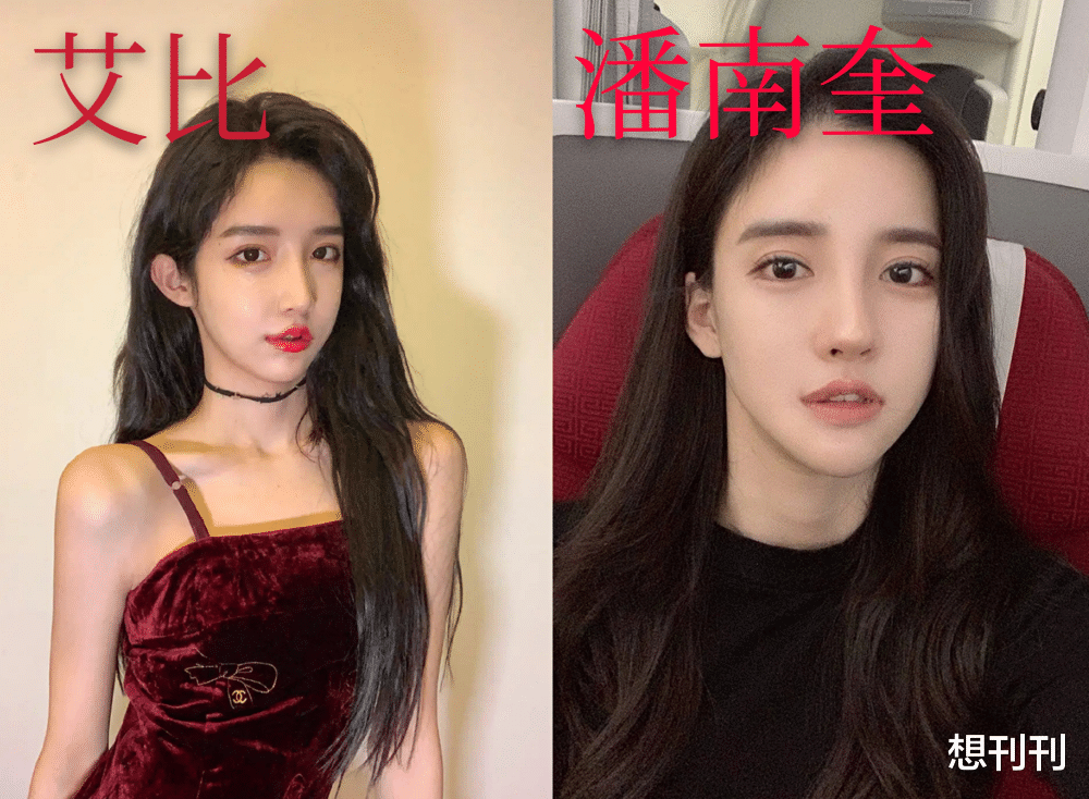 后遗症|做了颧骨内推的明星真的变美了吗?推平容易后悔难,后遗症一大堆