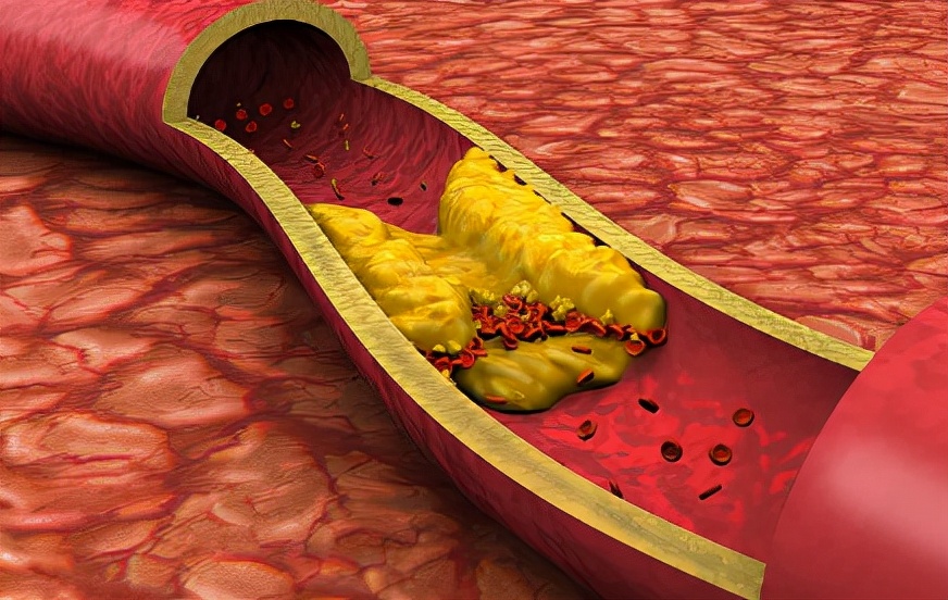 苹果|血液“稀释剂”找到了，白开水排第4，“第1”很多人没注意