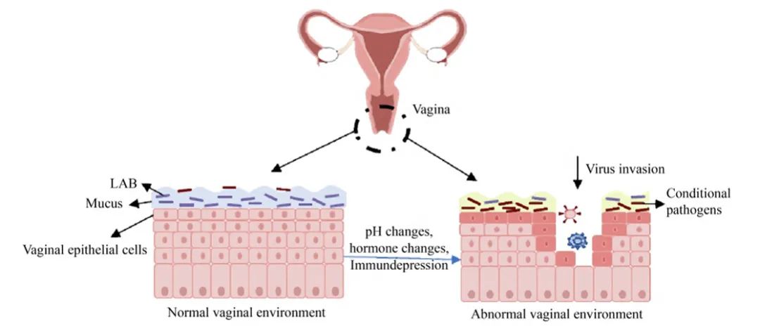 阴道炎|瘙痒，异味，疼痛，阴道炎重建菌群很重要。