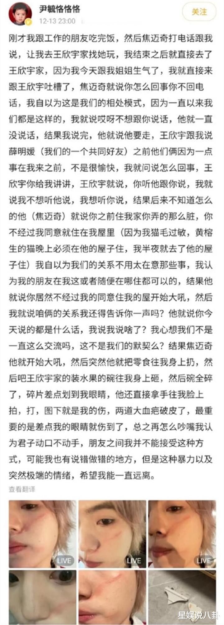 快乐男声|“快男”兄弟闹掰？深夜自曝挨揍，却遭网友怒斥：绿茶行为