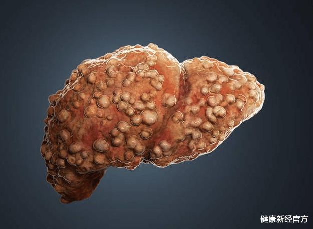 肝脏|伤肝“大户”已公布，牛肉未上榜，医生忠告：真正要远离的是这3种“肉”