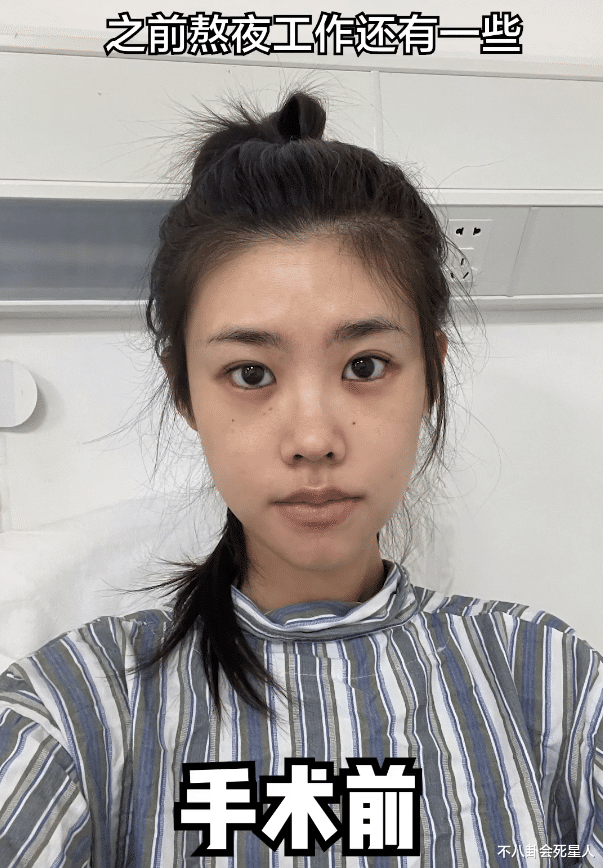 熬夜|千万网红程十安因熬夜患癌，25就切除卵巢，大西米也因熬夜进ICU