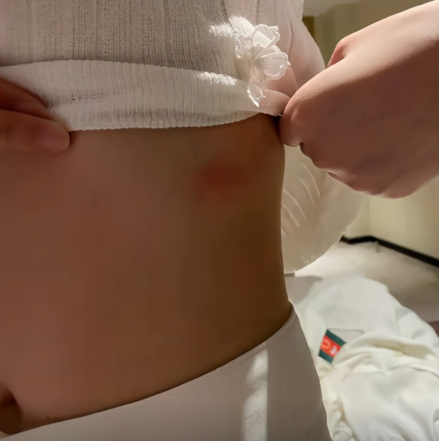 社會偵探員 女子住酒店發(fā)現(xiàn)床上都是蟲子，欲退房被拒，店家：別家還沒我家好