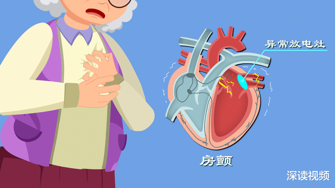 深读视频|心律失常咋回事？心慌胸闷背后真相是啥？房颤发病机制动漫版！