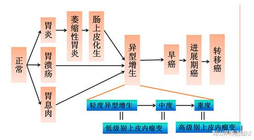 荆山浮屠话健康|胃痛消化不良也要注意萎缩性胃炎！哪些人是高危人群？会患胃癌吗