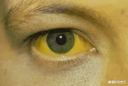 肝癌|25岁小伙每天坚持早起,查出肝癌,医生:早起后常吃1“蔬菜”犹如“自残”