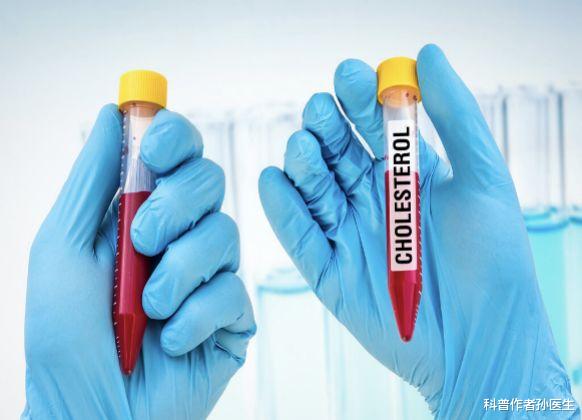 医生|45岁大叔因喝1种“水”,让甘油三酯降低,医生:方法不错,可借鉴