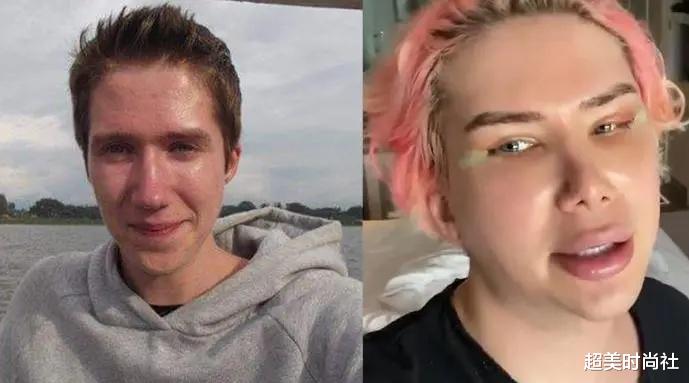 超美时尚社|英国男子花费近百万整成偶像，8年整容18次，自称自己是韩国人