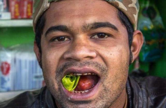 江湖微谈 40岁男子每天吃3包槟榔，结果患上口腔癌，医生：简直活该