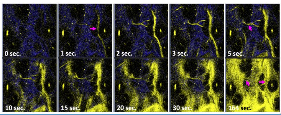 澳门大学 澳门大学研发创新磷光探针,有助精准切除肿瘤