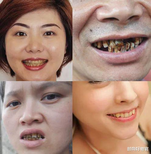 时尚好物官|被称为“国宝级”的牙膏,却因低价无人问津,景甜:用了半管黄渍就没了