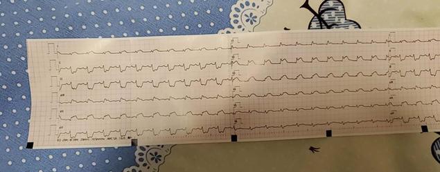 体检|医生眼里的6种“善良瘤”，确诊后先别慌，恶化概率很低