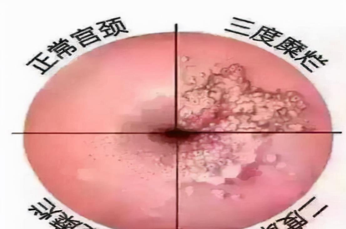 午美聊健康体态 体检时查出这4种病，或许无需过度治疗，不要自己吓唬自己