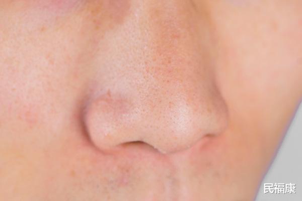 睡眠|鼻毛总是窜出鼻子，怎么办？看似没用的鼻毛，也不能随便用手拔