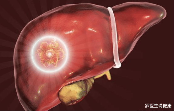 罗医生说健康|25岁男子身患肝癌，化疗2次离世，医生摇头：这种“桶装水”怎能常喝