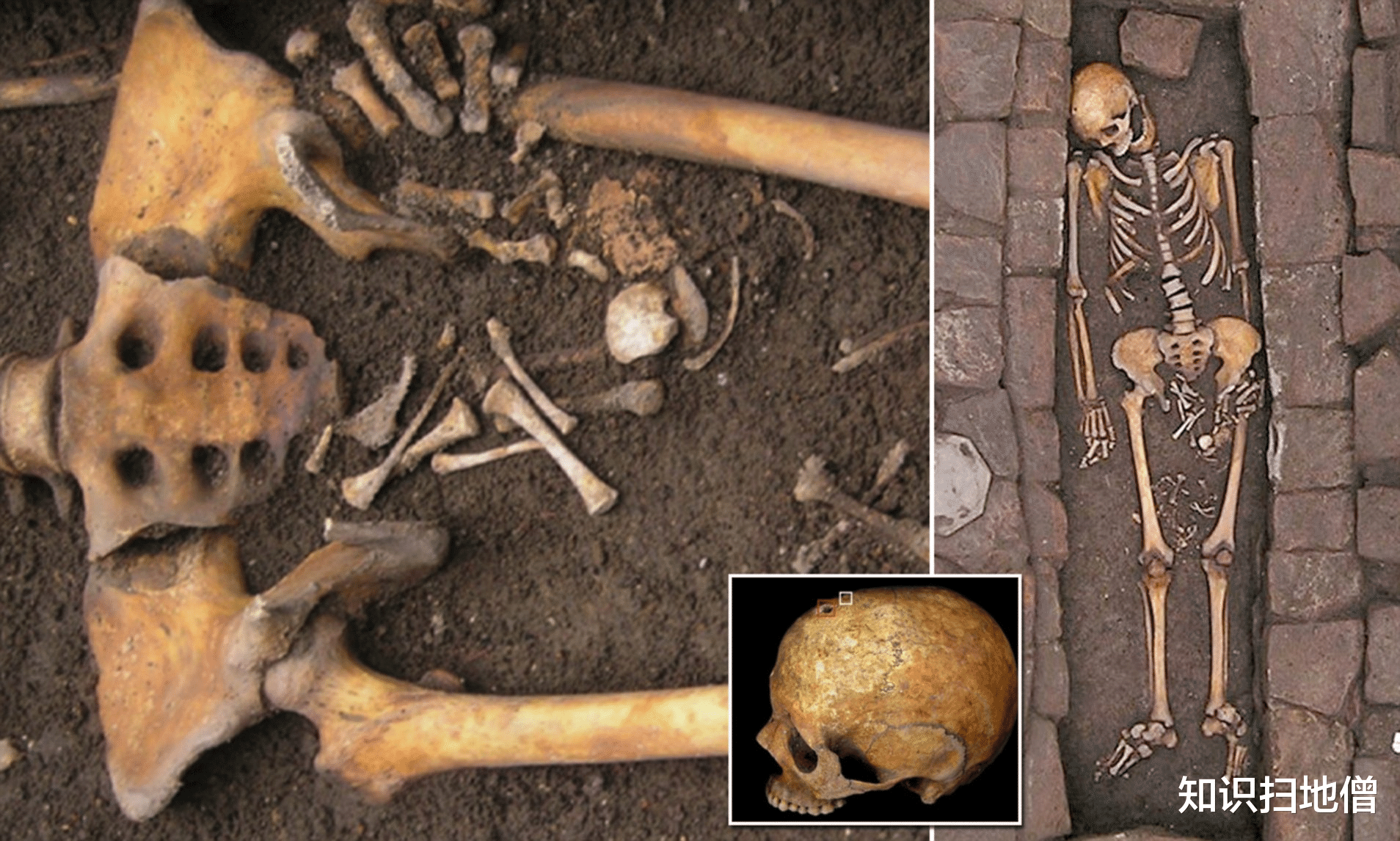 死人真能产子?死后10天在坟墓里生孩子的女人