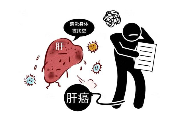 医生胡侃|怀疑自己得了肝癌，该怎么诊断？这6个诊断方法，你需要弄清楚