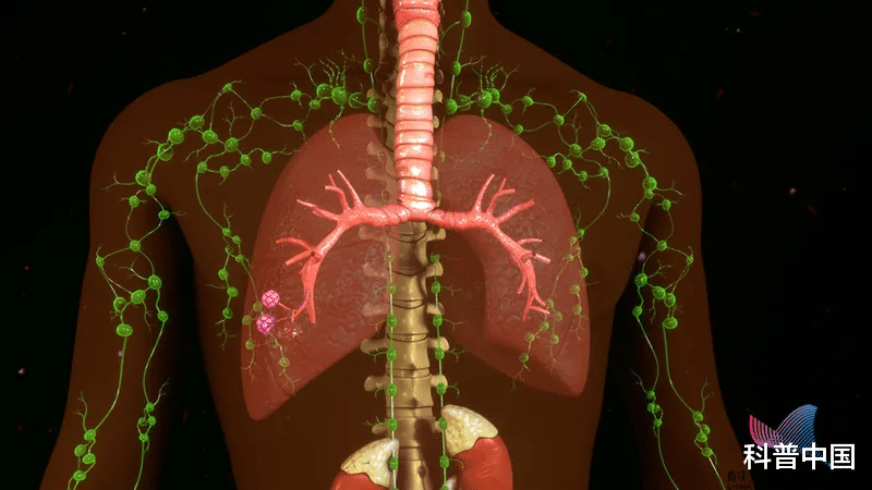 淋巴结|男孩腹痛难耐确诊淋巴瘤！淋巴结肿大是肿瘤信号？这些情况要当心