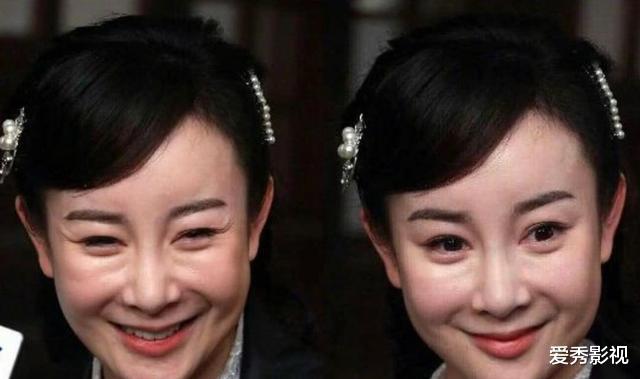 整容|10位被整容毁掉的女明星，蛇精脸，面容扭曲，被毁掉的不止是美丽