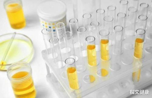 血糖|尿酸升高，身体会给你发出5个提示，警惕肾结石！医生建议：学会这3招，尿酸不再高