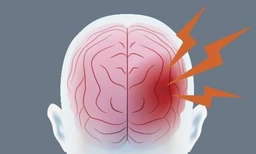 脑出血|血压高到多少会发生脑出血呢？医生给出“参考值”，请对照自查