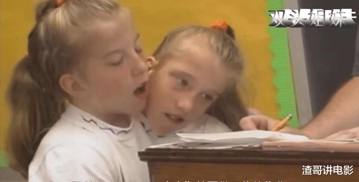 中国科学院|世界上真实存在的双头人，姐妹共用一个身体，却分别控制半边身体