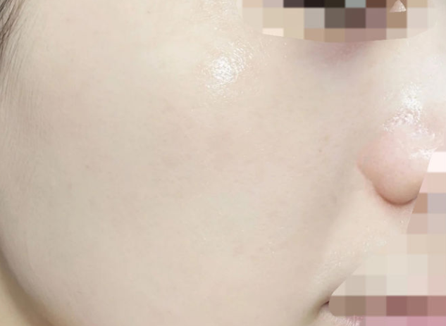 珂润|敏感肌烂脸踩雷排行榜!薇诺娜、珂润上榜!孕妇都能用的修复神器