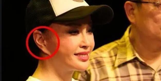 整容|脸成发面团，下巴能犁地？中老年女明星整容后遗症才是“重灾区”