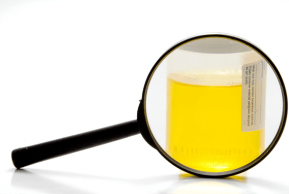 尿蛋白|尿蛋白保持长期稳定如何做？肾内医生指出3点，都做到不难