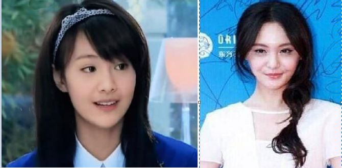 整容|盘点娱乐圈整容失败的女明星，有的整的像僵尸，最后一个可惜了