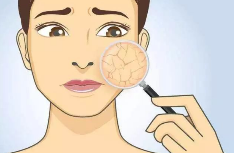 宁植安祛痘冻干粉 祛痘痘的这三个误区，你得知道，可以让祛痘更轻松！