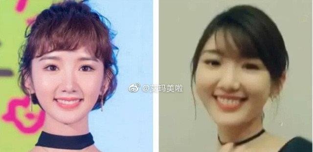 毛晓彤|毛晓彤《云襄传》开机脸肿，被质疑打针，本人在线辟谣：我只是肿