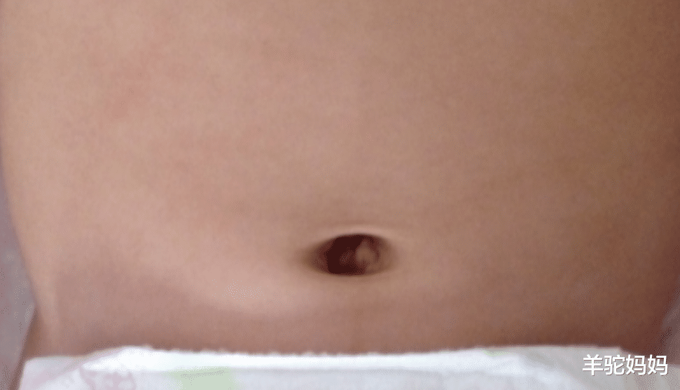 羊驼妈妈|宝宝肚脐眼里的“泥”究竟是啥？被显微镜放大1000倍，画面太酸爽