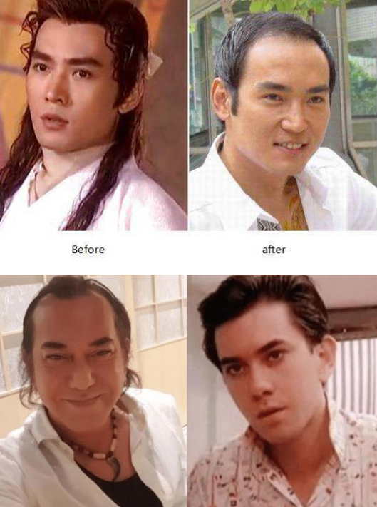 短发 型男护发, 用它想秃头还真的有点难！