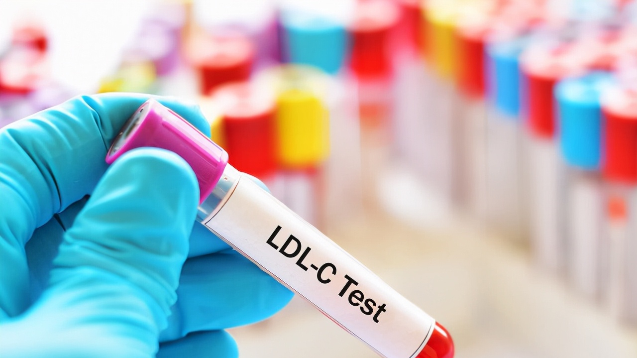 医生|糖友合并高血脂，该注意什么？医生直言：弄清4个问题，不再迷惑