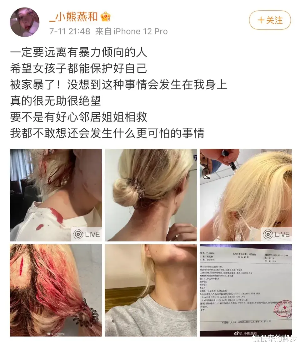 慢慢来的脚步|女子凌晨被当街掳走,施暴者却毫发无损:前男友凭什么成了免罪条款?