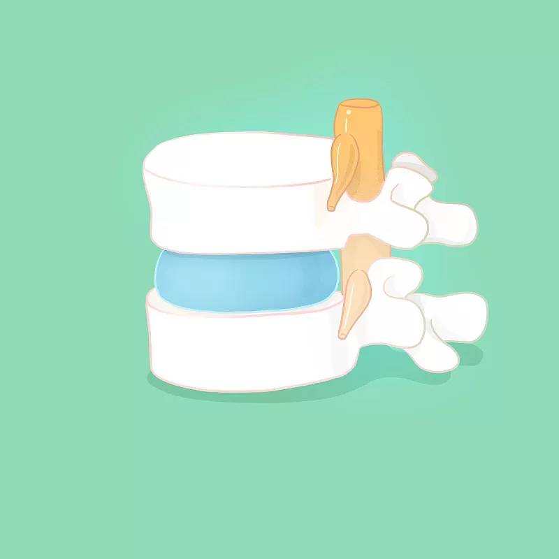  杭吉干细胞科技：干细胞移植改善椎间盘退变的研究现状及临床案例