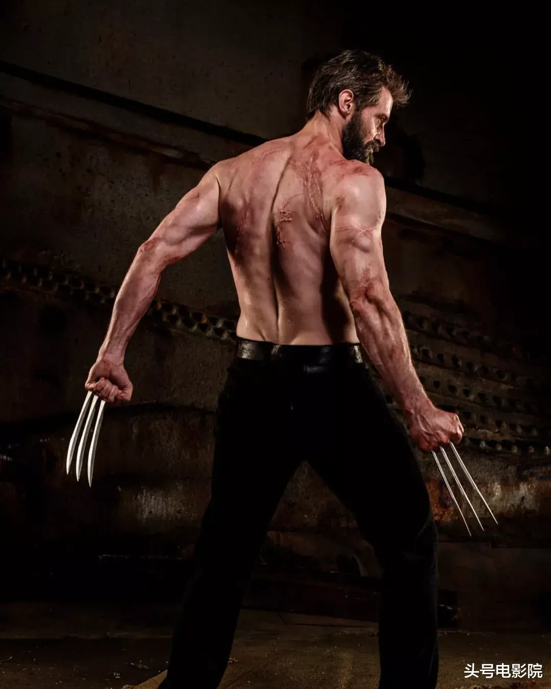 金刚狼|再爆皮肤癌危机！53岁金刚狼接受活检，与大13岁老婆结婚25年无孩