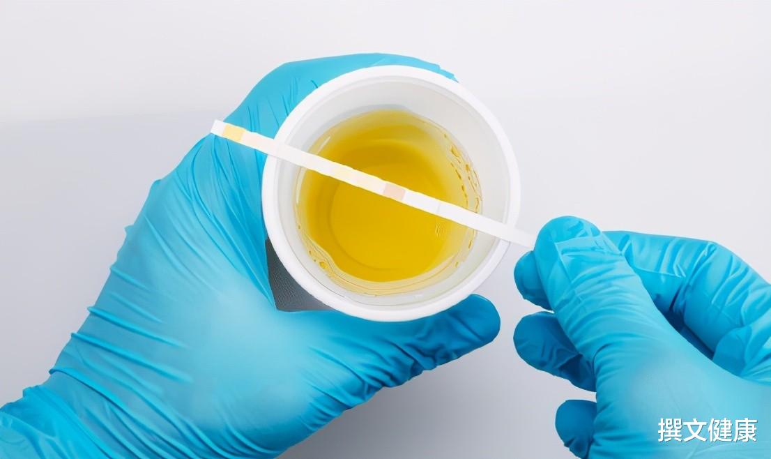 衰老|长期喝酒的人,晨起若有3种表现,或肝已变“硬”,专家提醒:坚持做3件事,肝会慢慢变好!